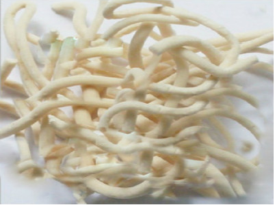 手揉核桃对保血管有好处